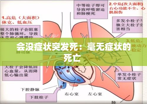 会没症状突发死：毫无症状的死亡 