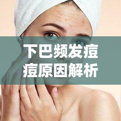 下巴频发痘痘原因解析及应对方法